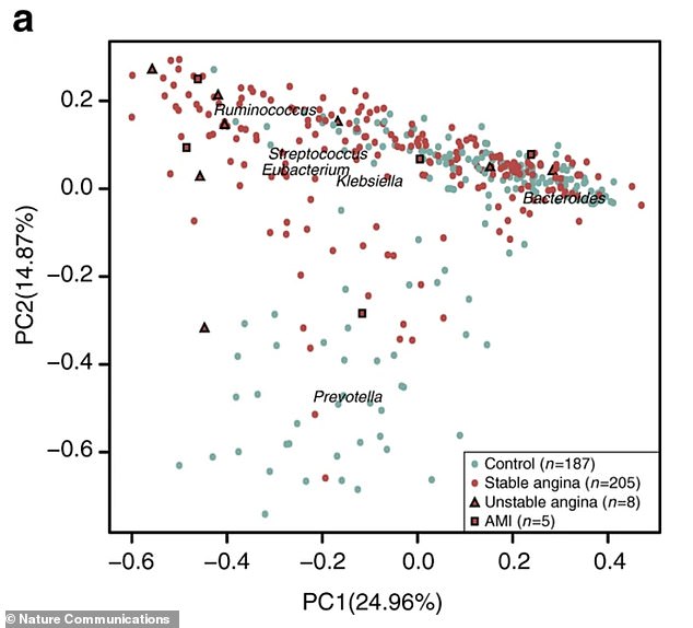 Bloating and Stomach Upset Could Signal Hidden Heart Risks, New Study Reveals