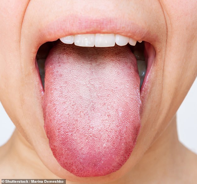 Tingling Tongue: A Hidden Health Warning You Can't Ignore