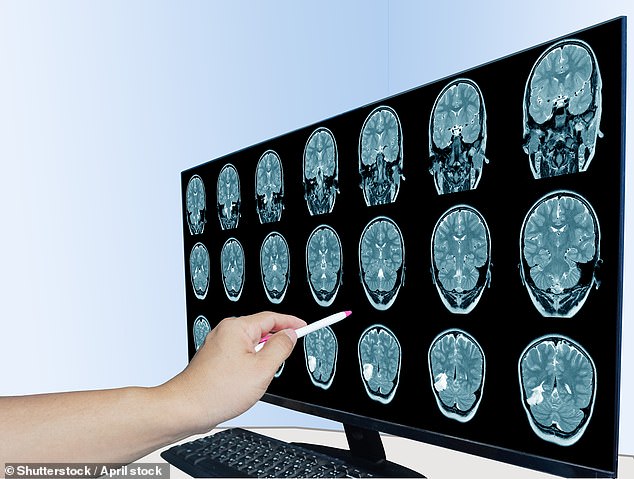 The Silent Epidemic: How Chronic Inflammation is Quietly Sabotaging Your Health