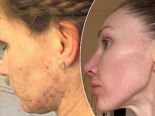 Collagen's Journey from Hype to Health: What the Research Reveals