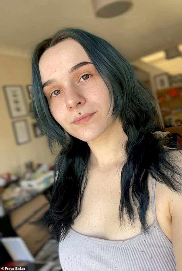 25-Year-Old Woman Faces Homelessness Due to Severe Hyperhidrosis