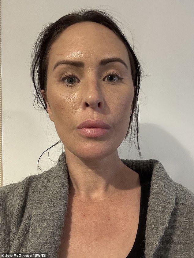 Adelaide Woman Spends £10,000 on Transformative Facelift in Turkey