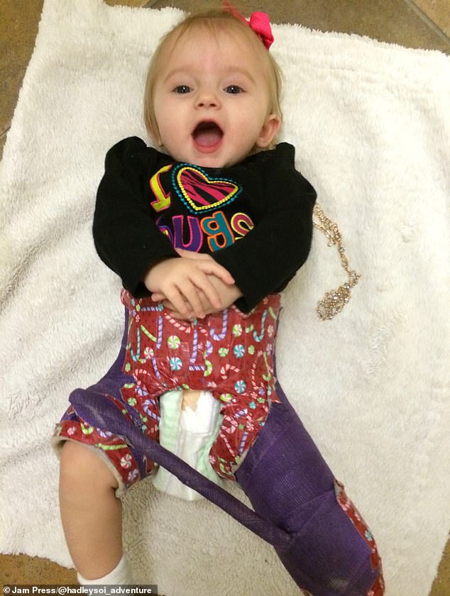 Baby Hadley's Unexplained Fractures Leave Family in Shock