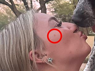 Baby Hadley's Unexplained Fractures Leave Family in Shock