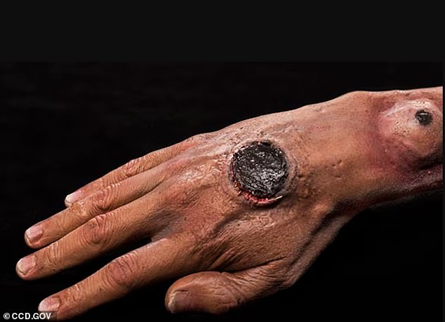 Deadly Anthrax Bacteria Found in Soil Across 43 U.S. States: Hidden Threat Lurks in Pastures and Burial Sites