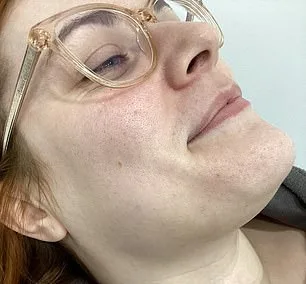 The Daily Ritual of Shaving: Living with Hirsutism and Its Emotional Toll