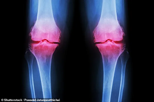 Columbia Scientists Develop 3D-Printed Lab-Grown Knee with Regenerative Potential for Osteoarthritis