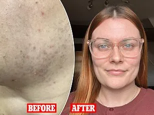 Aida Azizii's PCOS Journey: From Weight Struggles to Empowerment