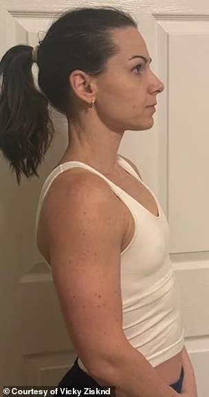 Scar-Free, No-Downtime Breast Augmentation: A New Surgical Breakthrough