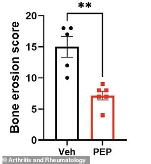Immune Peptide Found to Reverse Arthritis in Mice