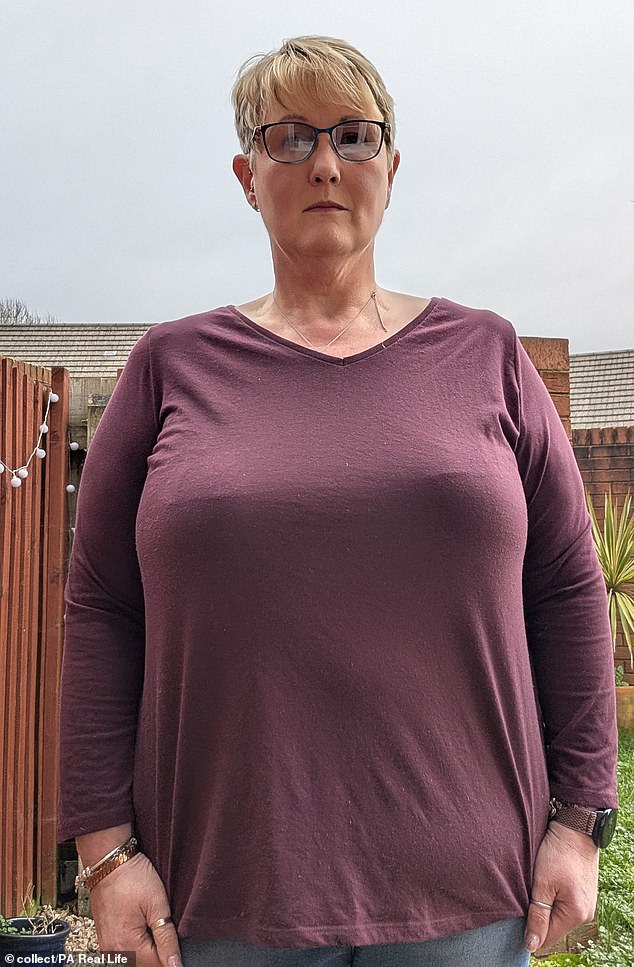 Joanna Brice seeks relief after decades of bullying and physical pain from massive breast reduction.