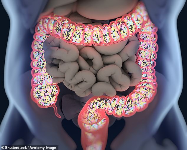 Scientists reveal how gut bacteria toxin fuels colon cancer in younger patients.