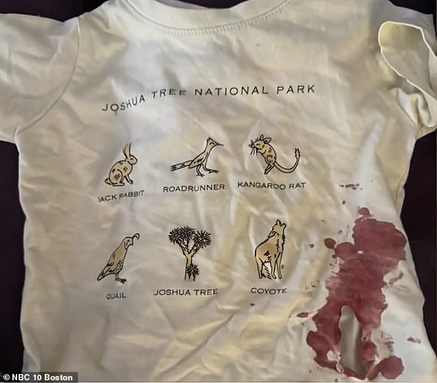 Toddler bitten by raccoon at Massachusetts playground requires rabies shots.