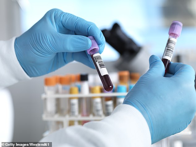 NHS trial shows blood test could save 30,000 lives annually by detecting cancer early.