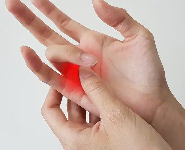 Understanding Trigger Finger: Symptoms, Causes, and Initial Treatment Options