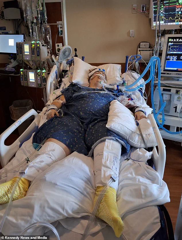 Vaping Nearly Cost Woman Her Life: Severe Lung Damage from E-Cigarette Use