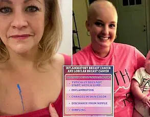 Young Mother's Grim Diagnosis: Breast Cancer Spreads to Liver and Brain