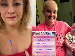 Young Mother's Grim Diagnosis: Breast Cancer Spreads to Liver and Brain