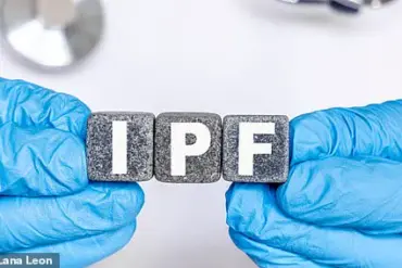 Cancer Drug Shows Promise in Treating Debilitating Lung Condition IPF
