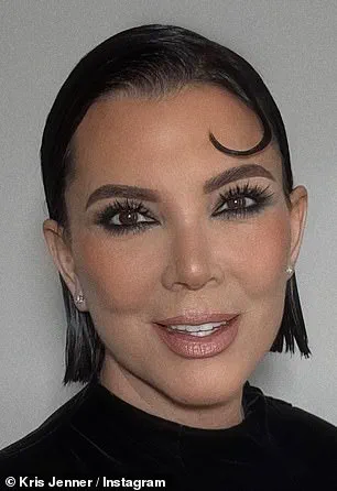 Donatella Versace's Dramatic Transformation Sparks Speculation About Medical Procedures