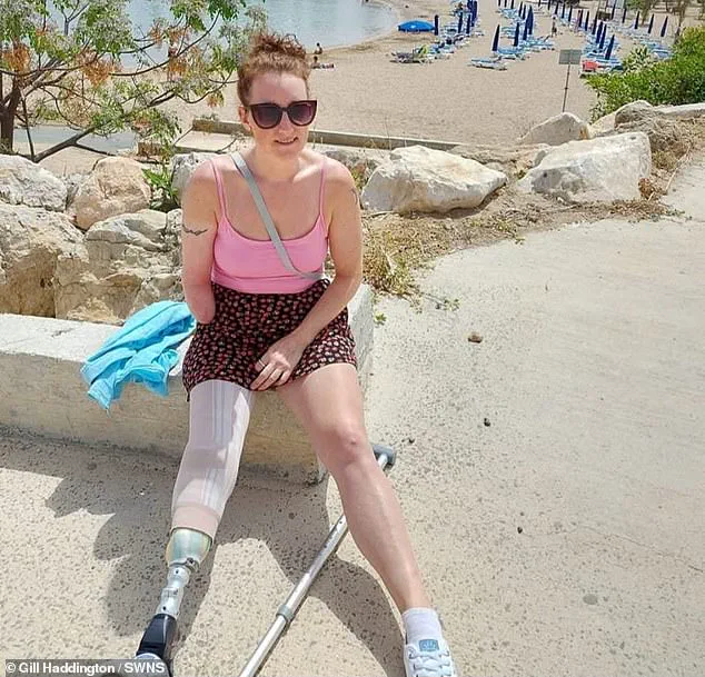 Woman Amputates Hand to Escape 'Suicide Disease' Complex Regional Pain Syndrome