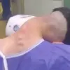 Dropped Head Syndrome: A Rare Consequence of Long-Term Drug Use Revealed in Shocking Images