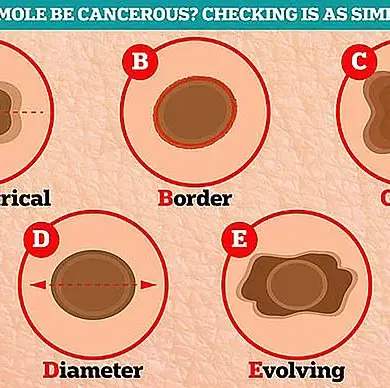 Privileged Access, Hidden Perils: The Melanoma Diagnosis of a Yacht Captain