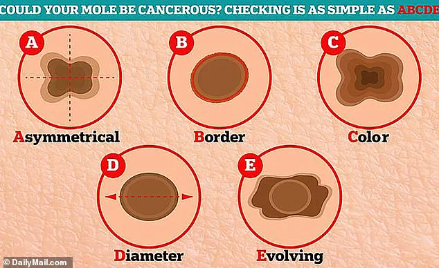 Privileged Access, Hidden Perils: The Melanoma Diagnosis of a Yacht Captain