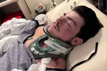19-Year-Old Chef Seriously Injured After Diving Accident at Hampton Beach; Collision with Unseen Sandbar Under Investigation