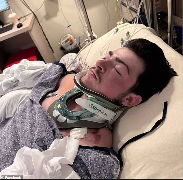 19-Year-Old Chef Seriously Injured After Diving Accident at Hampton Beach; Collision with Unseen Sandbar Under Investigation