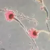 Deadly Fungus, Long Feared for Health Risks, May Hold Key to Blood Cancer Breakthrough, Study Suggests