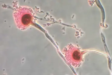 Deadly Fungus, Long Feared for Health Risks, May Hold Key to Blood Cancer Breakthrough, Study Suggests