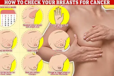 Groundbreaking Drug Enhertu Shows 50% Survival Boost for Aggressive Breast Cancer, Sparking Controversy Over Access in the UK