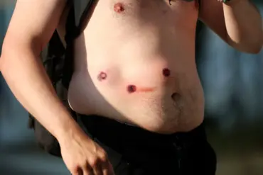 LAPD Escalates Tactics in Protest Response with Rubber Bullets and Pepperball Grenades