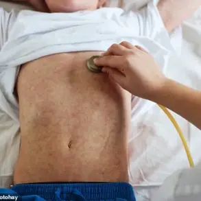 Urgent Public Health Alert: UK Expert Warns of Measles Resurgence Due to Declining Vaccination Rates