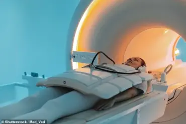 Urgent Warning: Rising CT Scan Usage Reveals Hidden Long-Term Risks, Experts Advise Caution Amid Surpassing Five Million Annually