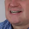 61-Year-Old Man from Essex Uses Shoelace to Extract Four Teeth After Failing to Access NHS or Private Dental Care