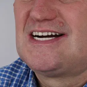 61-Year-Old Man from Essex Uses Shoelace to Extract Four Teeth After Failing to Access NHS or Private Dental Care