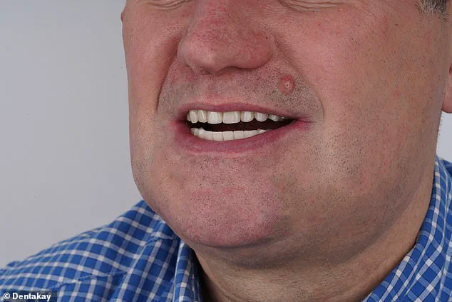 61-Year-Old Man from Essex Uses Shoelace to Extract Four Teeth After Failing to Access NHS or Private Dental Care