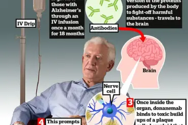 Breakthrough in Alzheimer's Treatment: New Drug Trontinemab Shows Promise in Clearing Amyloid Plaques and Slowing Disease Progression