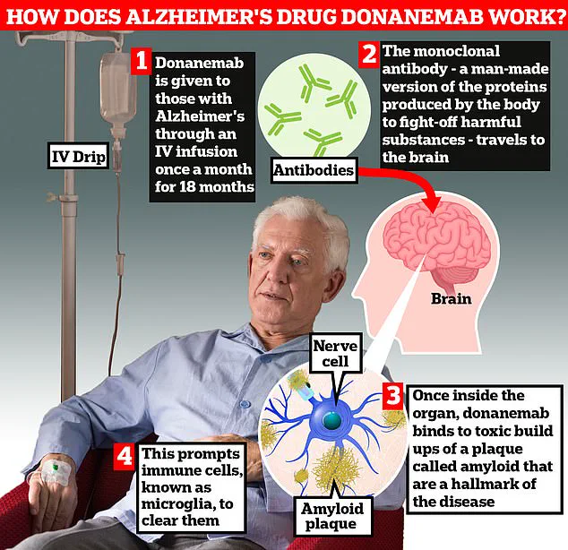 Breakthrough in Alzheimer's Treatment: New Drug Trontinemab Shows Promise in Clearing Amyloid Plaques and Slowing Disease Progression