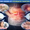 H. pylori Linked to Half of UK Stomach Cancers: Experts Urge Public Health Action