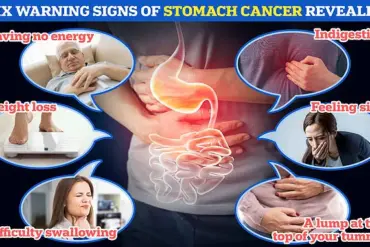 H. pylori Linked to Half of UK Stomach Cancers: Experts Urge Public Health Action