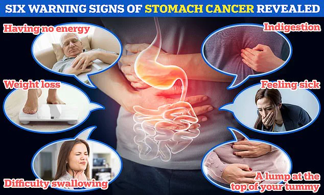 H. pylori Linked to Half of UK Stomach Cancers: Experts Urge Public Health Action