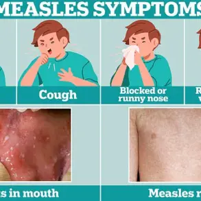 MMR Vaccination Rates Decline Sparks Fears of Measles Resurgence, Experts Warn