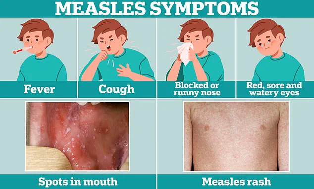 MMR Vaccination Rates Decline Sparks Fears of Measles Resurgence, Experts Warn