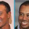 Tiger Woods: Legacy of Excellence and the Challenge of Aging in the Public Eye