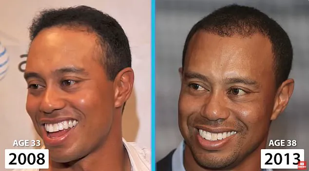 Tiger Woods: Legacy of Excellence and the Challenge of Aging in the Public Eye