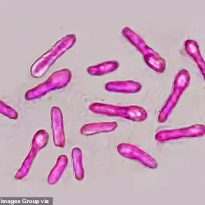 UK Health Security Agency Issues Urgent Warning Over Unlicensed Botox-Like Product Linked to Botulism Outbreak