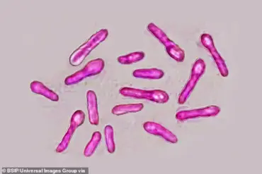 UK Health Security Agency Issues Urgent Warning Over Unlicensed Botox-Like Product Linked to Botulism Outbreak